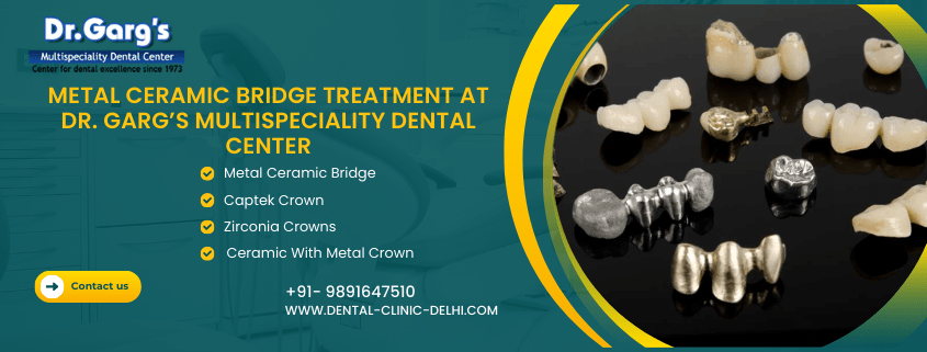DentalCrownMetalCeramic